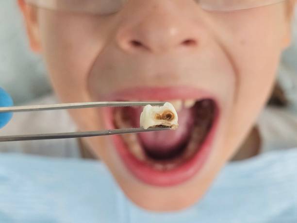 Best Urgent Tooth Repair  in Westlake, TX
